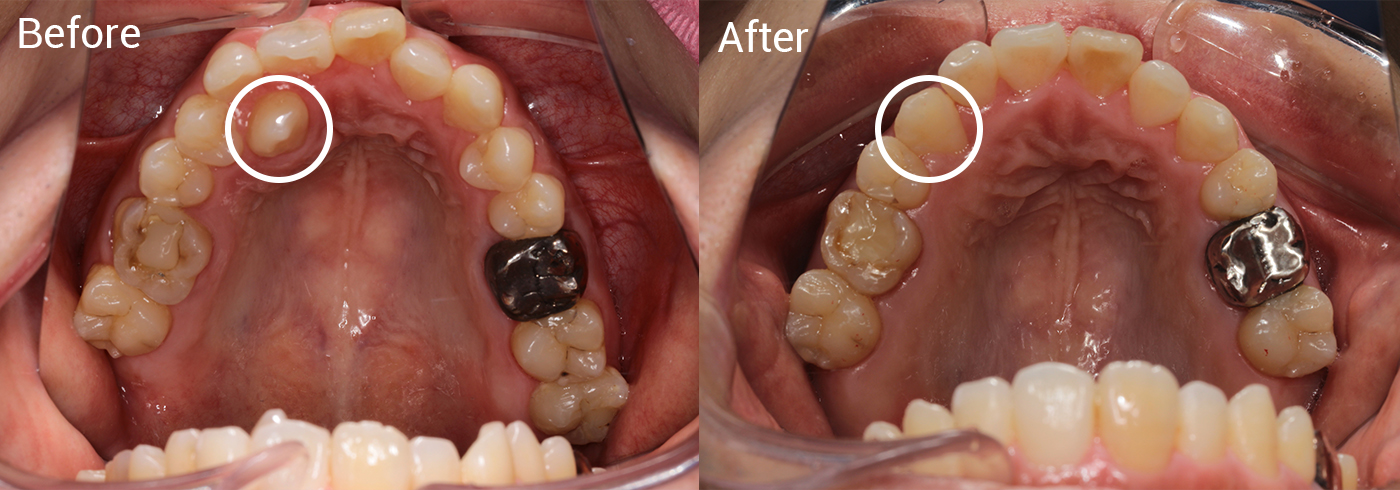 歯並びが気になる、咬み合わせが悪い