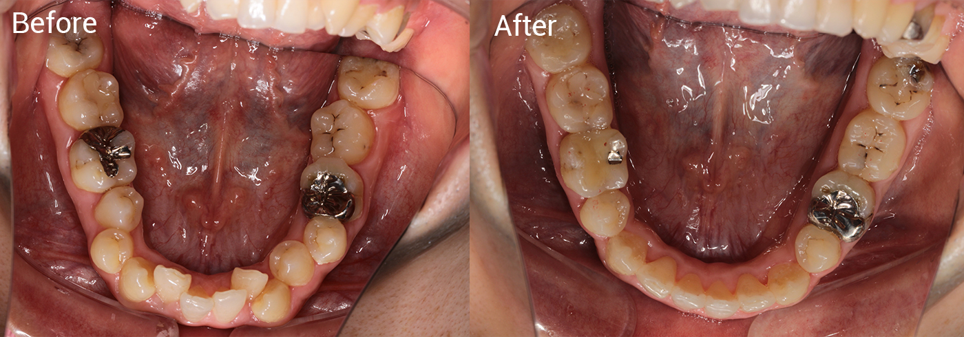 歯並びが気になる、咬み合わせが悪い