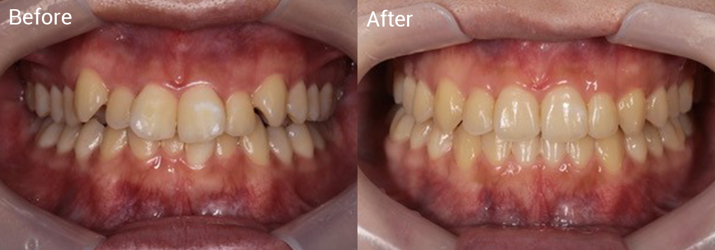 顎関節が痛くて口を開けられない、歯並びが気になる
