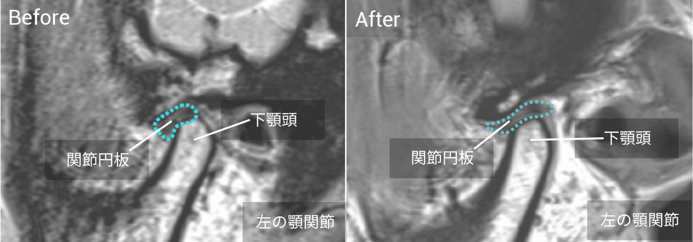 前歯の突出が気になる